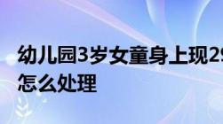 幼儿园3岁女童身上现29处针眼教师虐待孩子怎么处理