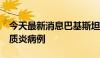 今天最新消息巴基斯坦今年已发现9例脊髓灰质炎病例